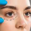 Plasma Pen clinica Giulia