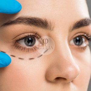 eliminacion bolsas y ojeras plasma ion