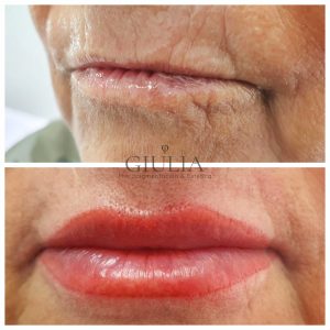 Micropigmentación Labios clinica Giulia con aumento Micropigmentación Labios clinica Giulia con aumento