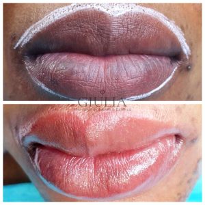 Micropigmentación Labios oscuros Micropigmentación Labios Giulia