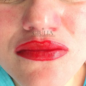 Pigmentación Labios rojos clinica Giulia Pigmentación Labios rojos clinica Giulia