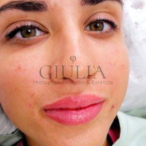 Micropigmentación Labios