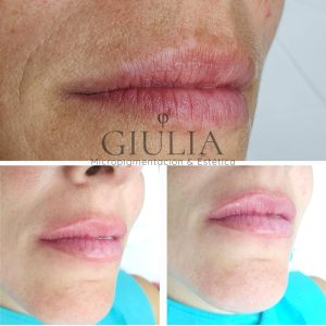 Micropigmentacion Labios Micropigmentacion Labios