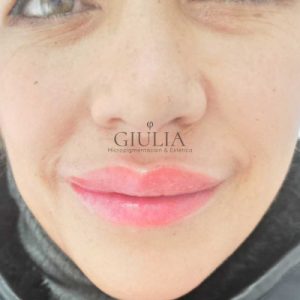 Pigmentacion Labios Giulia Pigmentacion Labios Giulia